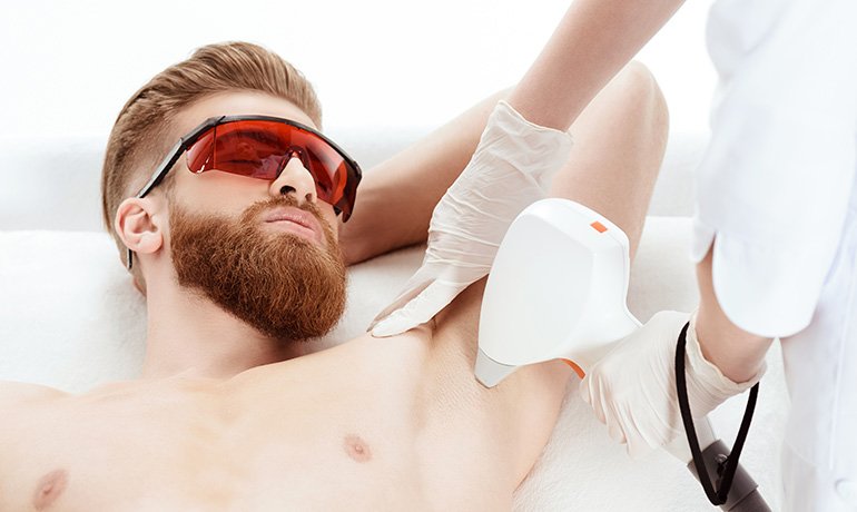 Hair Removal Laser